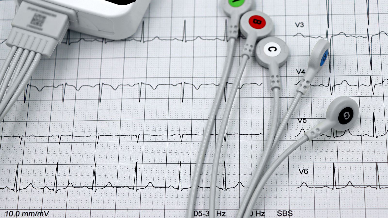 Apple Watch ECG: How to Use It, What It Actually Detects, and When to Worry